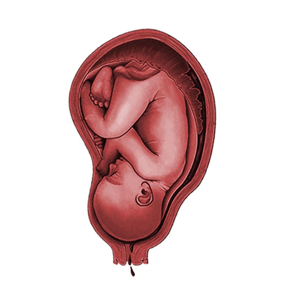 bayi 1 a